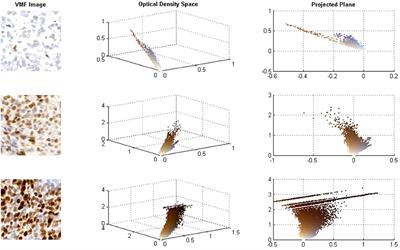 IHC Color Histograms for Unsupervised Ki67 Proliferation Index Calculation